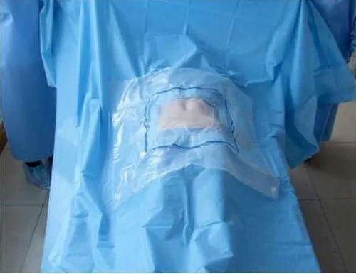 C-Section Drape - Surgical Drape Set